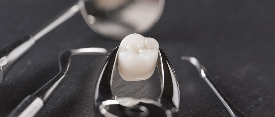 Why are Wisdom Teeth often such a pain?