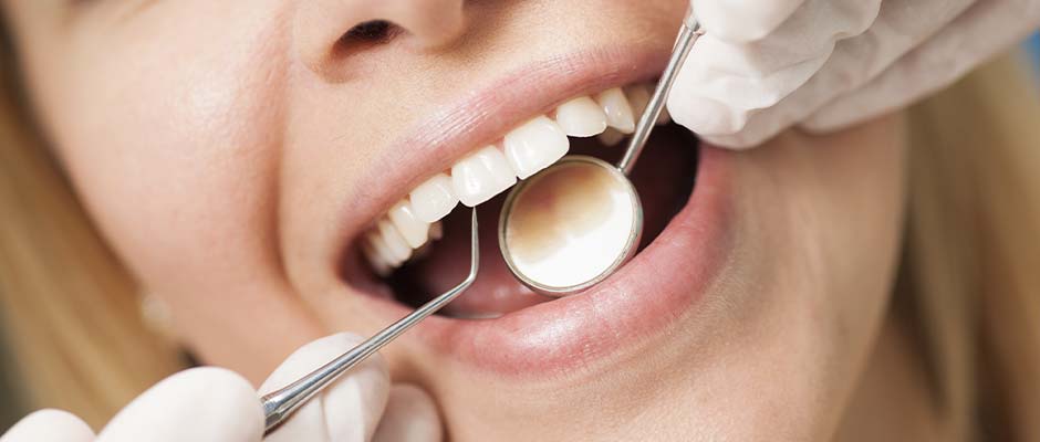 Keep your smile sparkling with professional dental cleaning