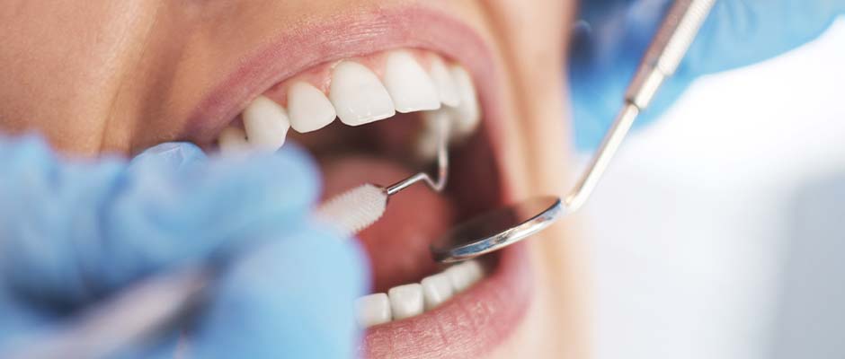 Did You Know Dentists Provide Oral Cancer Screenings?