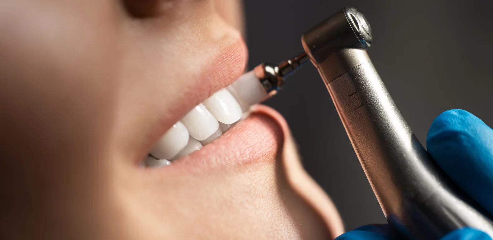 Dental cleaning
